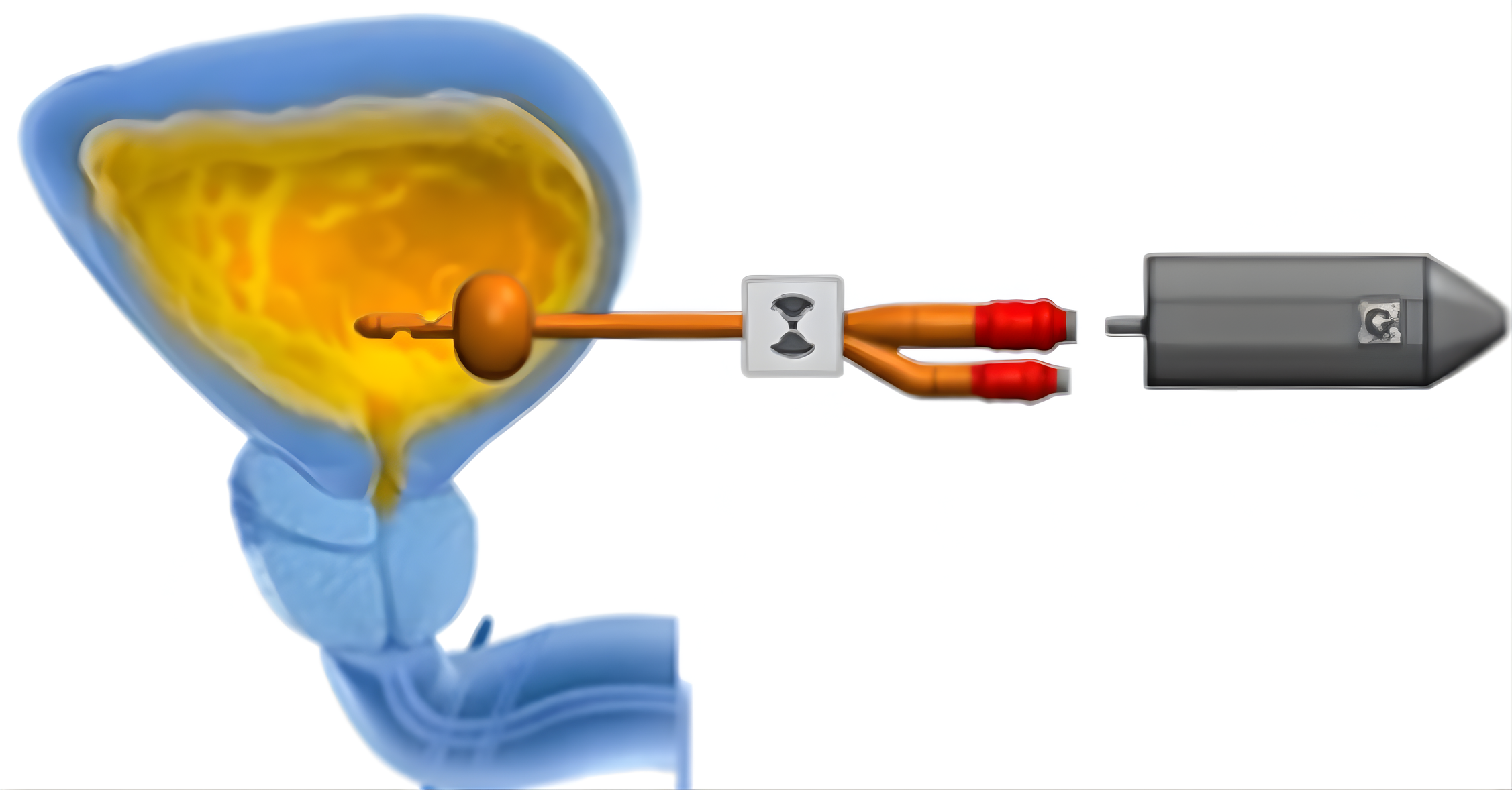 SupraSense sensor-enabled drainage